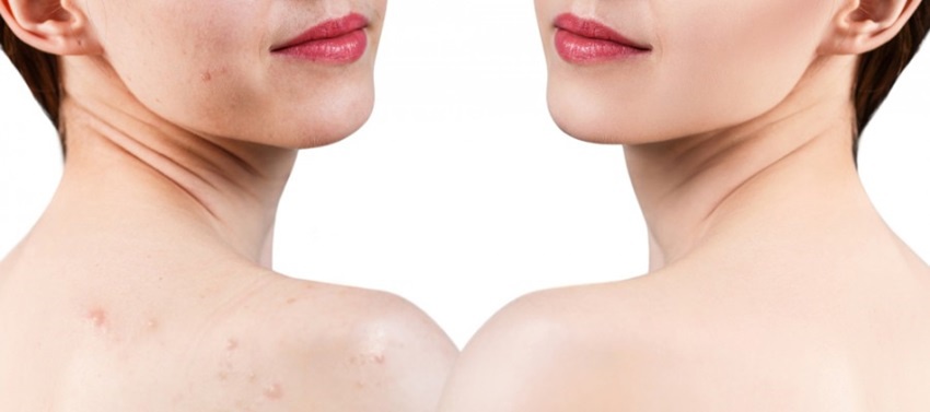 Kórejská kozmetika