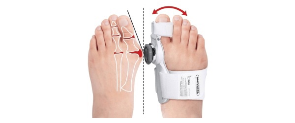 Korektor na haluxy okolo priehlavku