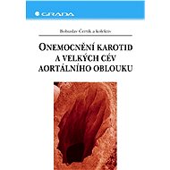 Onemocnění karotid a velkých cév aortálního oblouku - Elektronická kniha