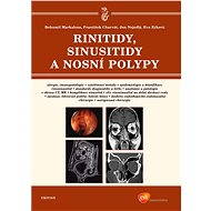 Rinitidy, sinusitidy a nosní polypy - E-kniha