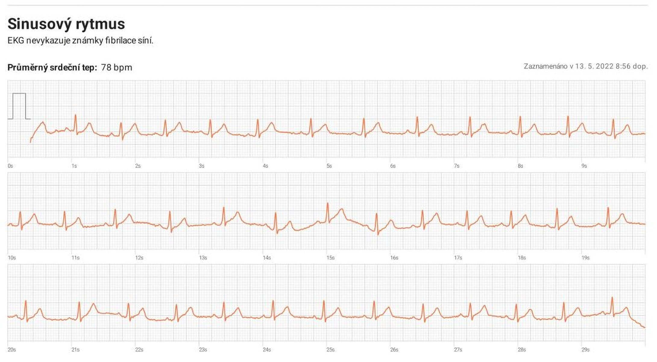 Samsung Health