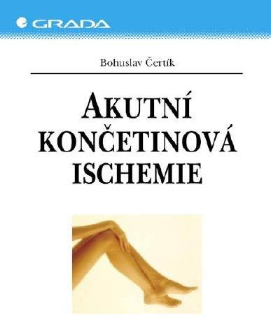 Akutní končetinová ischemie