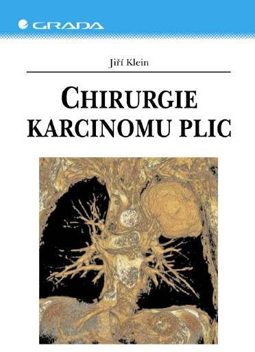 Chirurgie karcinomu plic