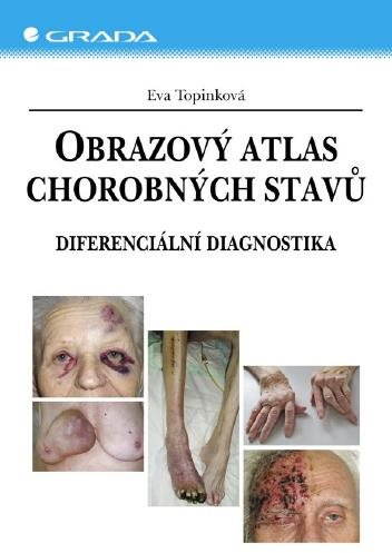 Obrazový atlas chorobných stavů