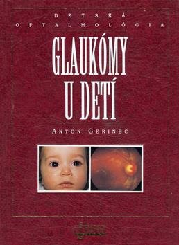 Glaukóm u detí: detská oftalmológia