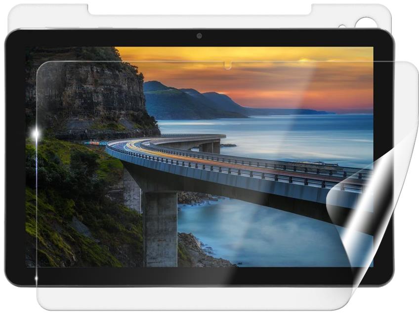 Screenshield IGET Smart W30 fólia na celé telo